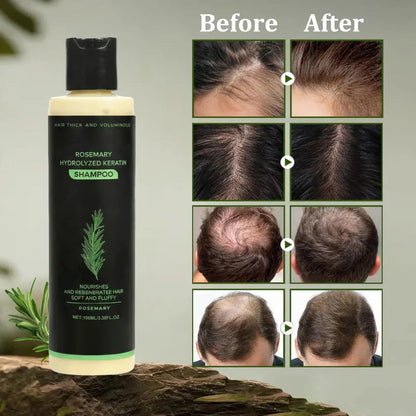 (🔥LAST 3 HOURS SALE - 70% OFF)🌱 TRoot Revival Hair Growth Serum