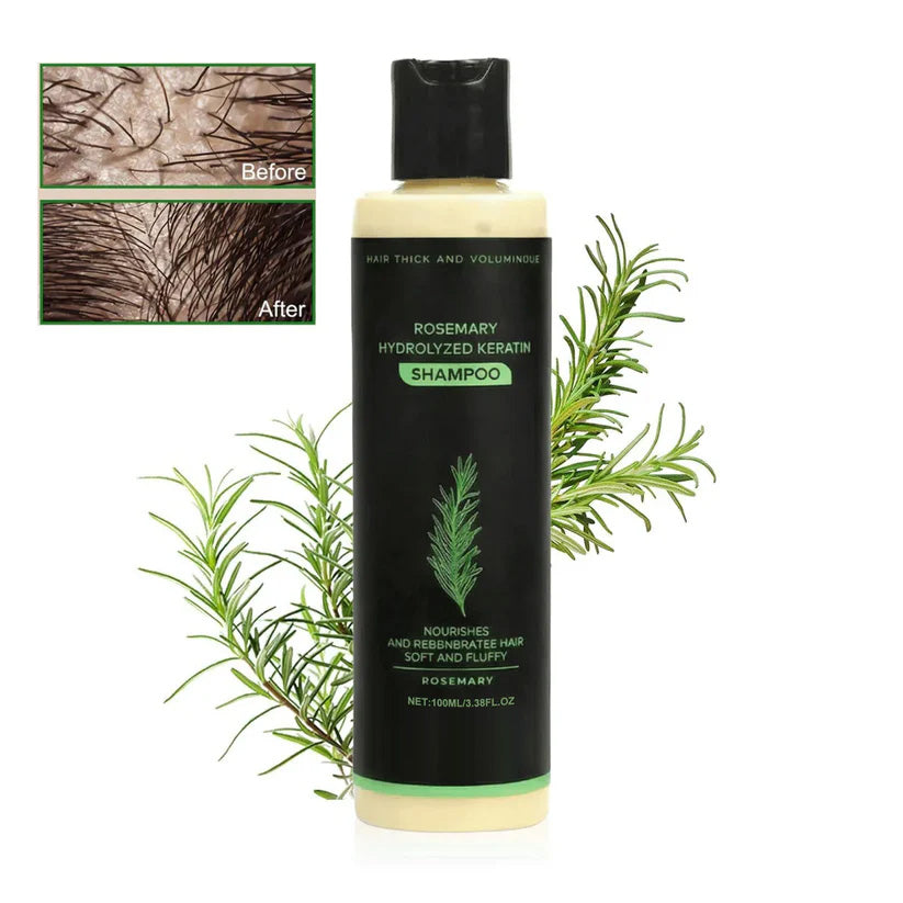 (🔥LAST 3 HOURS SALE - 70% OFF)🌱 TRoot Revival Hair Growth Serum